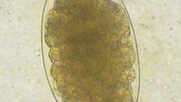 Ancylostoma duodenalem, vajíčko