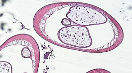 Dirofilaria repens je parazitický červ...