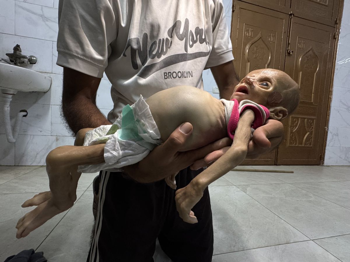 Telo šesťmesačného palestínskeho dieťaťa, ktoré...