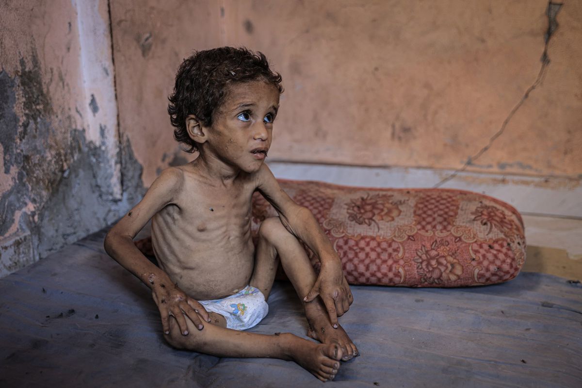 Pásmo Gaza, hlad, hladomor, genocída, Gaza,...