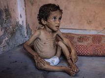 Pásmo Gaza, hlad, hladomor, genocída, Gaza, Palestínčan