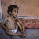 Pásmo Gaza, hlad, hladomor, genocída, Gaza, Palestínčan