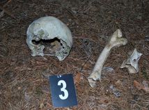 Kostra / Lebka / Bones / Skeleton /