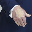 Trump, ruka, škvrna