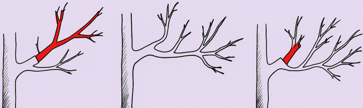 Kresby znázorňujú postupné skracovanie konára...