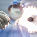 skalpel, chirurg, operácia