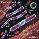 Na Ukrajine sa šíri „zabudnutá“ choroba z čias prvej svetovej vojny.  Postihnutým hrozí septický šok