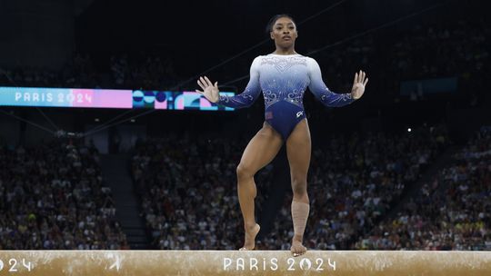 Bilesová prezradila bolestivú cenu za krásu. Jej prednosti vraj po plastike pripomínali mimozemšťanov