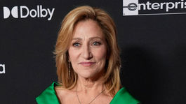 Edie Falco