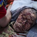 Ukrajina, Rusko, dronový a raketový útok, vojna, Kyjev, zničené budovy, bombardovanie, civilisti, AP,