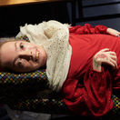 Petra Eller, svalová atrofia