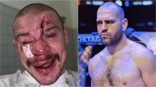 Krvavý pražský kúpeľ pre Slovákov. Princ bratislavský schytal výprask, nečakaný knokaut pre Budaya