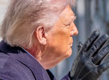 USA Politika prezident Pokožka Začervenanie Liečba