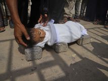 úmrtie dieťa gaza podvýživa hladomor